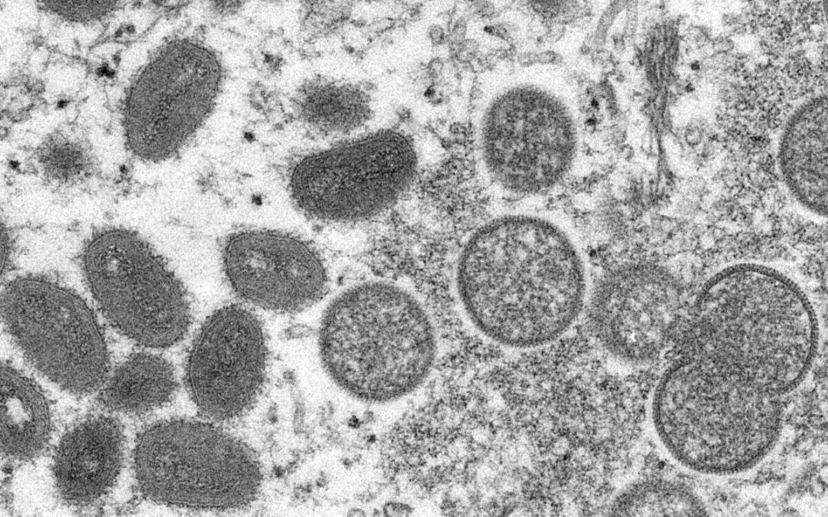 virus símico 1