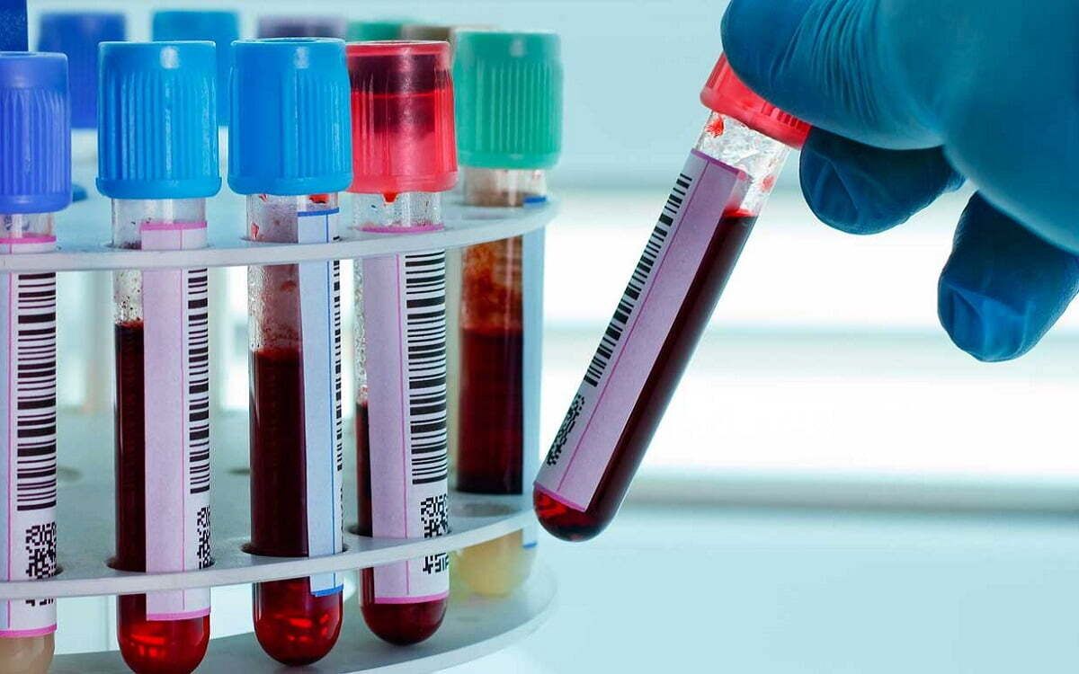 Por fin, muestras de sangre sin agujas